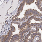 Immunohistochemical staining of human fallopian tube shows moderate cytoplasmic positivity in glandular cells.