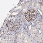Immunohistochemical staining of human kidney shows moderate cytoplasmic positivity in cells in glomeruli.