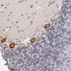 Immunohistochemical staining of human cerebellum shows cytoplasmic positivity in purkinje cells.