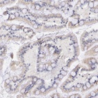 Anti-GAL3ST1 Antibody