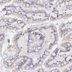 Anti-GAL3ST1 Antibody