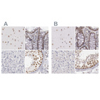 Anti-DGCR14 Antibody