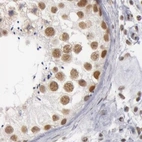 Immunohistochemical staining of human testis using Anti-DGCR14 antibody HPA001221.