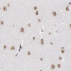 Immunohistochemical staining of human cerebral cortex using Anti-DGCR14 antibody HPA001221.