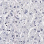 Immunohistochemical staining of human liver using Anti-DGCR14 antibody HPA001221.