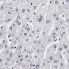 Anti-DGCR14 Antibody