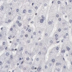 Immunohistochemical staining of human liver using Anti-DGCR14 antibody HPA001221.