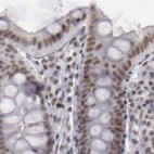 Immunohistochemical staining of human colon using Anti-DGCR14 antibody HPA001221.