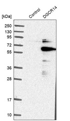 Anti-DGCR14 Antibody