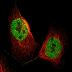 Immunofluorescent staining of human cell line U-2 OS shows localization to nucleoplasm.