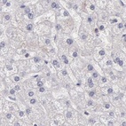 Anti-DGCR14 Antibody