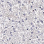 Immunohistochemical staining of human liver using Anti-DGCR14 antibody HPA001222.