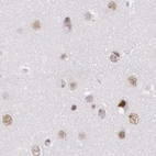 Immunohistochemical staining of human cerebral cortex using Anti-DGCR14 antibody HPA001222.