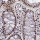 Immunohistochemical staining of human colon using Anti-DGCR14 antibody HPA001222.