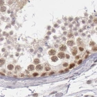 Immunohistochemical staining of human testis using Anti-DGCR14 antibody HPA001222.