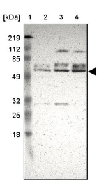 Lane 1: Marker [kDa] 219, 112, 85, 49, 32, 25, 18_br/_Lane 2: Human cell line RT-4_br/_Lane 3: Human cell line U-251MG sp_br/_Lane 4: Human cell line A-431