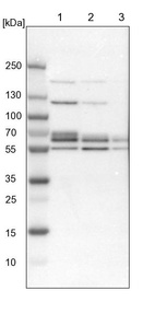 Lane 1: NIH-3T3 cell lysate (Mouse embryonic fibroblast cells)_br/_Lane 2: NBT-II cell lysate (Rat Wistar bladder tumour cells)_br/_Lane 3: PC12 cell lysate (Pheochromocytoma of rat adrenal medulla)