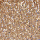 Anti-CBS Antibody