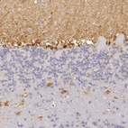 Immunohistochemical staining of human cerebellum shows moderate cytoplasmic positivity in a subset of cells in granular layer, as well as in neuropil of molecular layer.