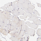 Immunohistochemical staining of human skeletal muscle shows no positivity in striated muscle fibers as expected.
