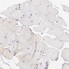 Immunohistochemical staining of human skeletal muscle shows no positivity in striated muscle fibers as expected.