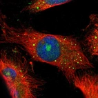 Immunofluorescent staining of human cell line U-251 MG shows localization to nucleoli & vesicles.