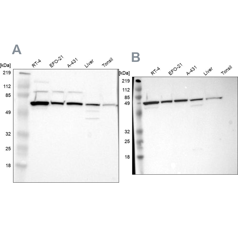 Anti-CKAP4 Antibody
