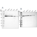 Anti-CKAP4 Antibody