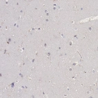 Immunohistochemical staining of human cerebral cortex shows low expression as expected.