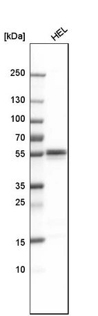 Western blot analysis in human cell line HEL.