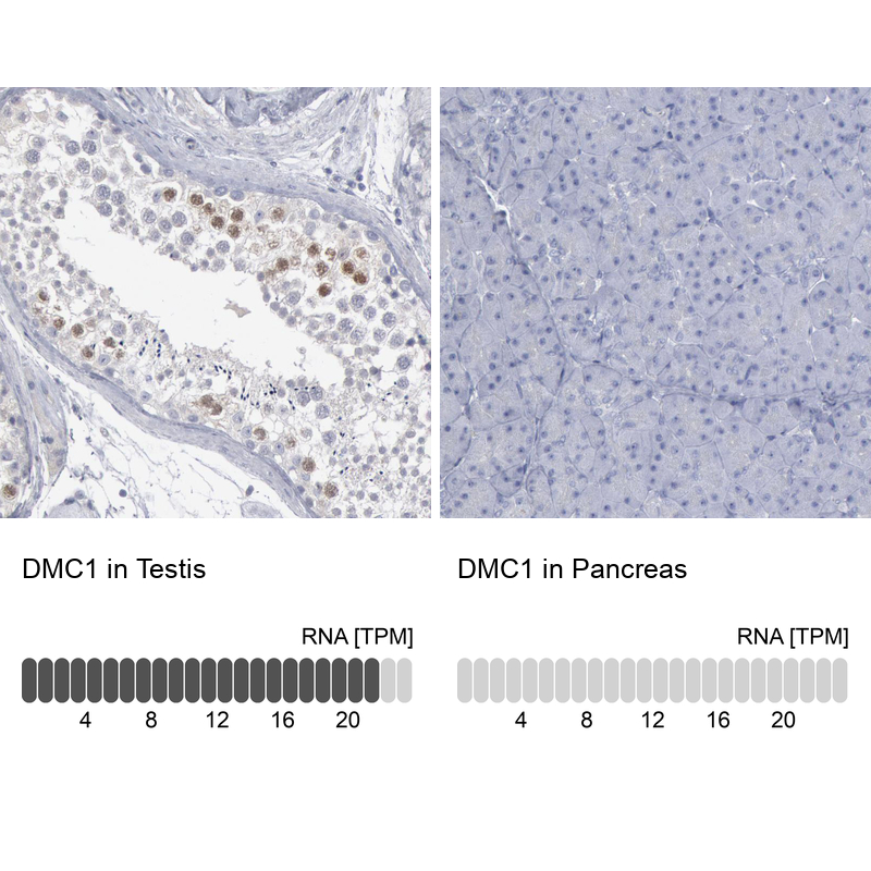 Anti-DMC1 Antibody