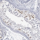 Immunohistochemical staining of human testis shows moderate nuclear positivity in a subset of cells in seminiferous ducts.
