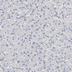 Immunohistochemical staining of human liver shows no expression in hepatocytes as expected.