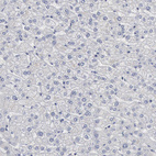 Anti-DMC1 Antibody