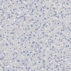 Immunohistochemical staining of human liver shows no expression in hepatocytes as expected.