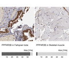 Anti-PPP4R3B Antibody