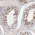 Immunohistochemical staining of human testis shows strong nuclear positivity in seminiferous ducts cells.