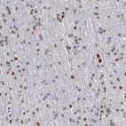 Immunohistochemical staining of human cerebral cortex shows weak to moderate nuclear positivity in neurons.