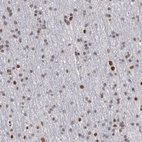 Immunohistochemical staining of human cerebral cortex shows weak to moderate nuclear positivity in neurons.