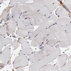Immunohistochemical staining of human skeletal muscle shows no positivity in myocytes as expected.