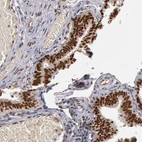 Immunohistochemical staining of human fallopian tube shows strong nuclear positivity in glandular cells.
