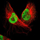 Anti-PPP4R3B Antibody