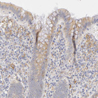 Anti-PLOD3 Antibody
