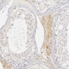 Immunohistochemical staining of human testis shows weak to moderate cytoplasmic positivity in Leydig cells.