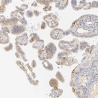 Immunohistochemical staining of human placenta shows weak to moderate cytoplasmic positivity in trophoblastic cells.