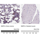 Anti-MMP9 Antibody