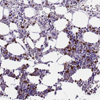 Immunohistochemical staining of human bone marrow shows strong cytoplasmic positivity in hematopoietic cells.