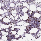 Immunohistochemical staining of human bone marrow shows strong cytoplasmic positivity in hematopoietic cells.