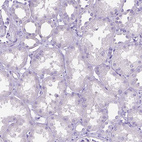 Immunohistochemical staining of human kidney shows no positivity in cells in tubules as expected.