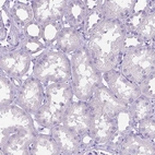 Immunohistochemical staining of human kidney shows no positivity in cells in tubules as expected.